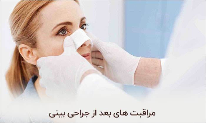  مراقبت های پس از جراحی بینی ( رینوپلاستی )