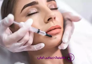 شرایط و مزایای بوتاکس چانه برای زیبایی